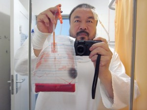 Photo Ai Wei Wei took of himself in hospital after being beaten by theChinese police