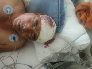 Monk Tashi Sonam was shot in his head; receives treatment in a hospital in Dartsedo Photo: tibet.net